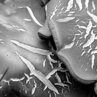 Fungus